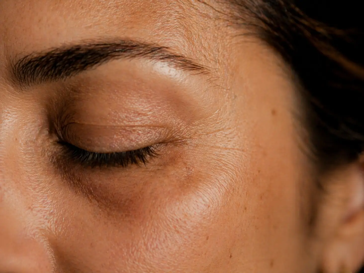 Antes do preenchimento