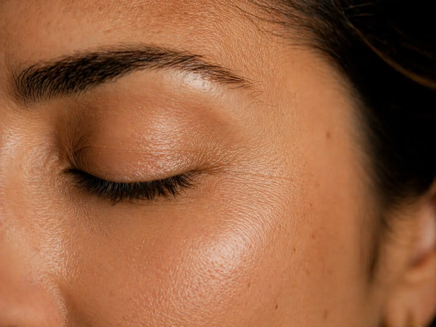 Depois do preenchimento